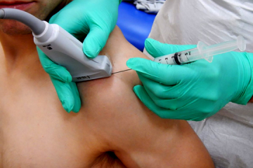 Ultrasound Guided Injections